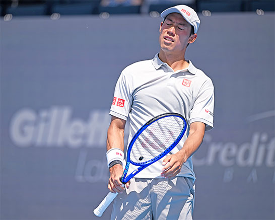 錦織圭